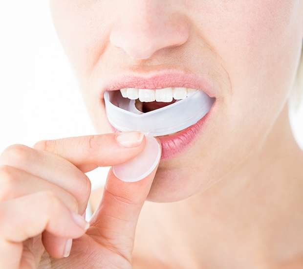 Magnolia Mouth Guards